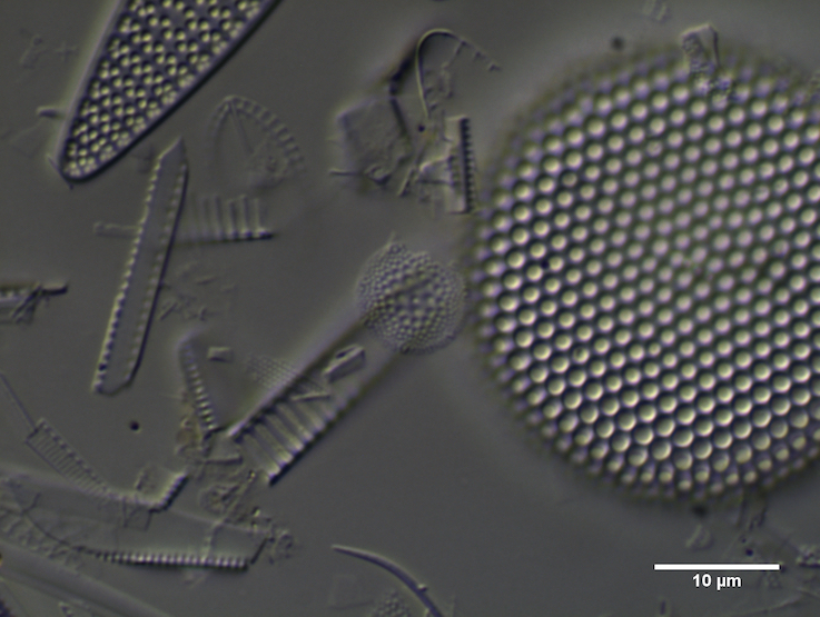 Electron microscope picture of diatoms